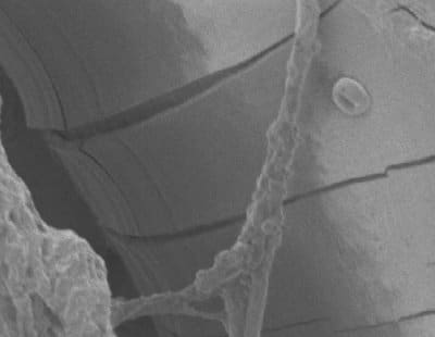 Degraded Polypropylene Hernia Mesh
