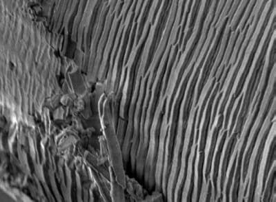Degraded Hernia Mesh