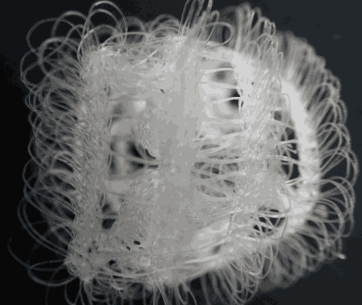Hernia Mesh Plug Lawsuit